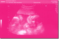 Ultrasound Scan Art Print 15 x 10 cm - Deep pink
