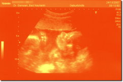 Ultrasound Scan Art Print 15 x 10 cm - Orange red