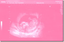 Ultrasound Scan Art Print 15 x 10 cm - Pastel pink