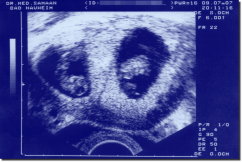 Ultraschallbild Kunstdruck 15 x 10 cm - Königsblau