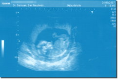 Ultrasound Scan Art Print 15 x 10 cm - Sky blue