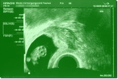 Ultrasound Scan Art Print 30 x 20 cm - Forest green
