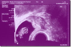 Ultrasound Scan Art Print 30 x 20 cm - Purple
