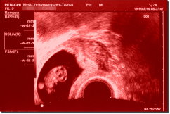 Ultrasound Scan Art Print 60 x 40 cm - Dark red