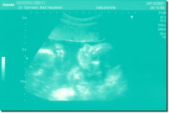 Ultrasound Scan Art Print 60 x 40 cm - Turquoise