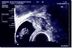 Ultrasound Scan Jigsaw - Black / blue