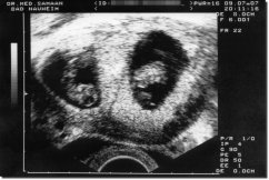 Ultrasound Scan Jigsaw - Black / white